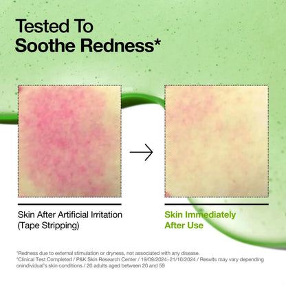 Anua Azelaic Acid 10 Hyaluron Redness Soothing Serum